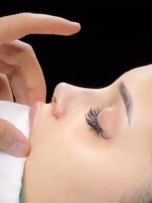 پرتکرارترین سوالات عمل بینی و پاسخ کامل متخصص جراحی بینی