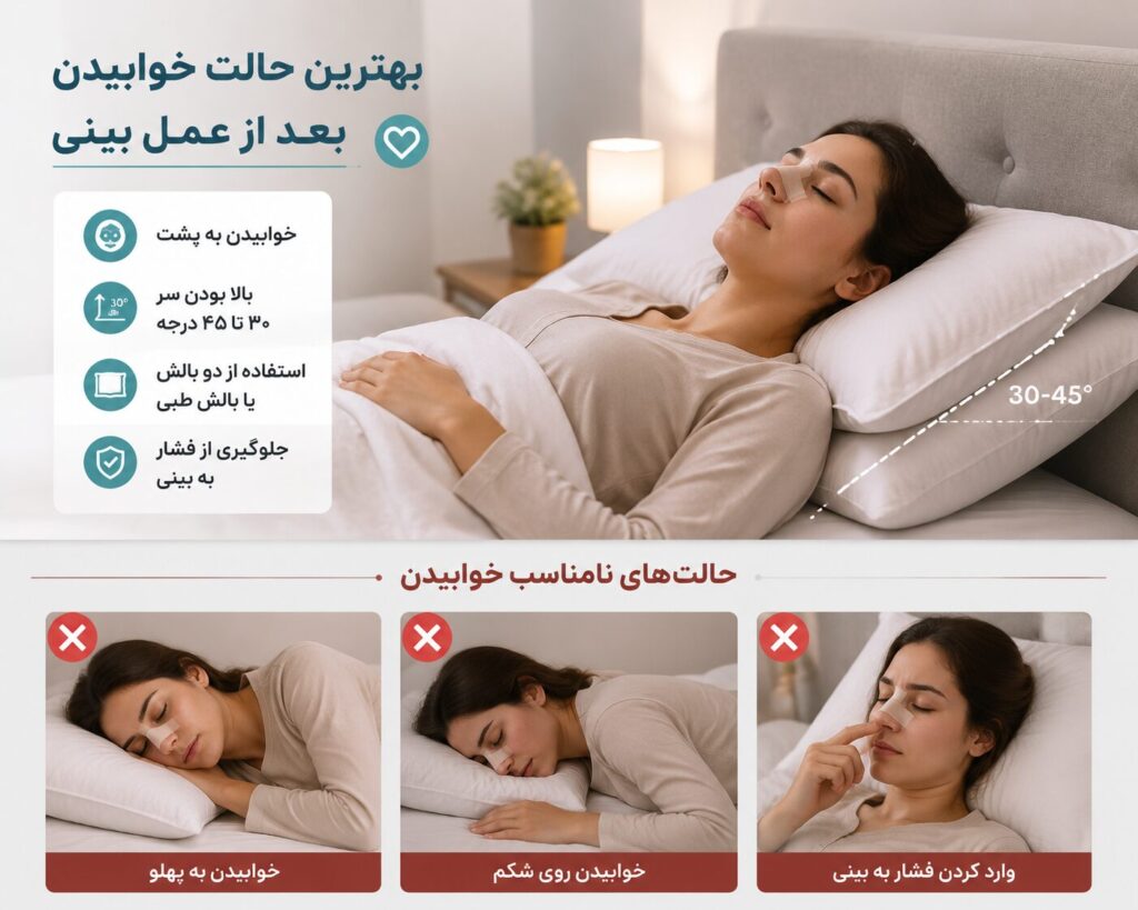 بهترین حالت خوابیدن بعد از عمل بینی برای کاهش ورم