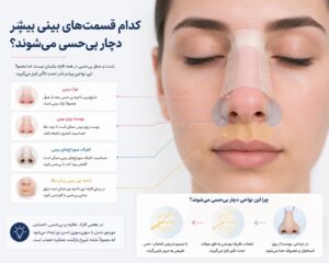 قسمت‌های مختلف بینی که بعد از عمل دچار بی‌حسی می‌شوند