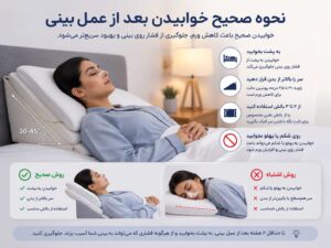 نحوه صحیح خوابیدن بعد از عمل بینی