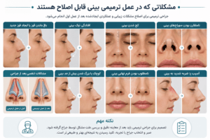 مشکلاتی که ممکن است به عمل ترمیمی بینی نیاز داشته باشند