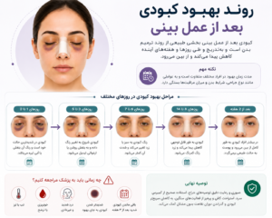 روند بهبود کبودی بعد از عمل بینی در روزهای مختلف