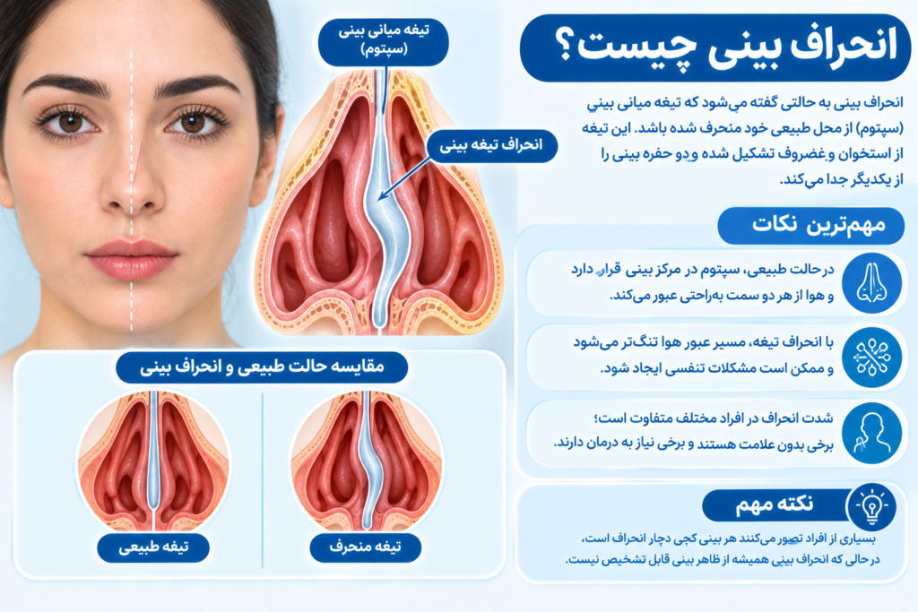 انحراف بینی و انحراف تیغه میانی بینی