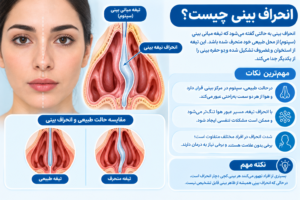 انحراف بینی و انحراف تیغه میانی بینی