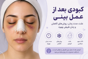 کبودی بعد از عمل بینی و اطراف چشم