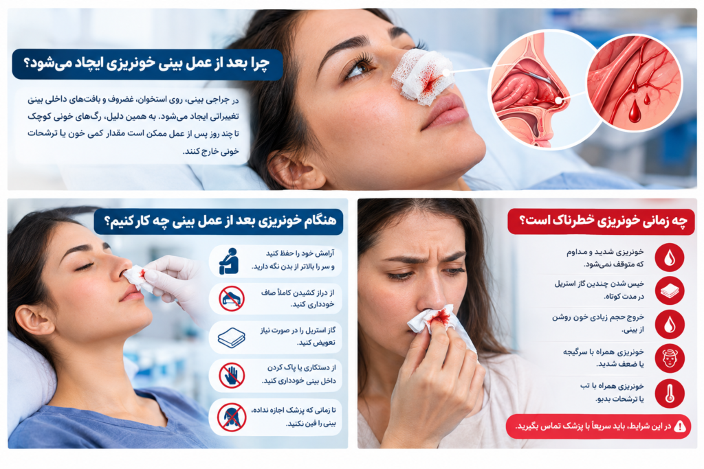 خونریزی بعد از عمل بینی و علت ایجاد آن