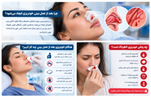 خونریزی بعد از عمل بینی و علت ایجاد آن