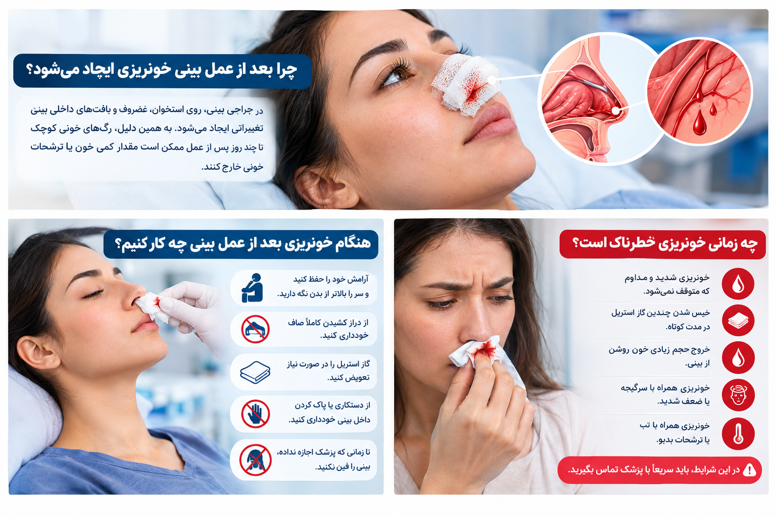 خونریزی بعد از عمل بینی و علت ایجاد آن