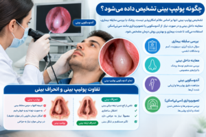 تشخیص پولیپ بینی با آندوسکوپی و سی تی اسکن