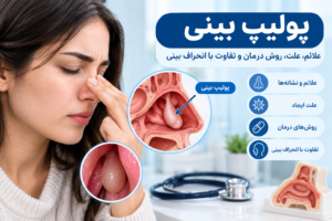پولیپ بینی، علائم، علت و روش درمان