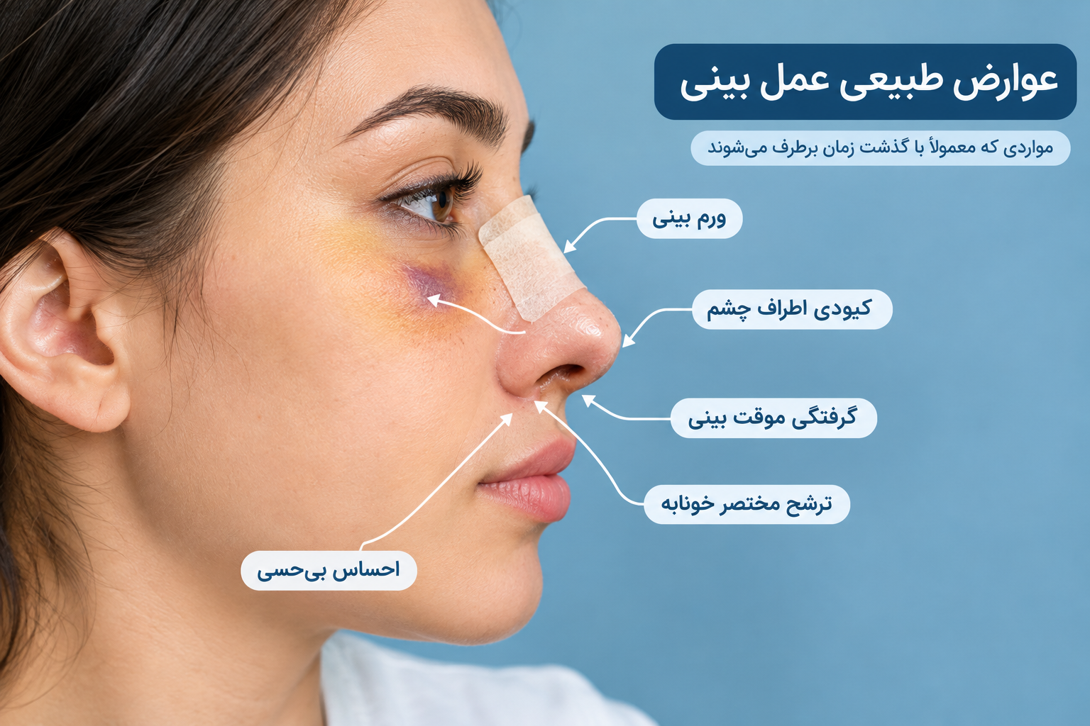 عوارض طبیعی بعد از عمل بینی مانند ورم، کبودی و گرفتگی بینی