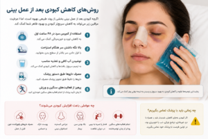 روش‌های کاهش کبودی بعد از عمل بینی