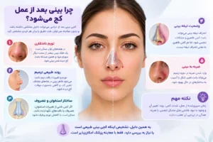 علت کج شدن بینی بعد از عمل
