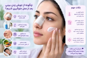 روش‌های پیشگیری از جوش بینی بعد از عمل